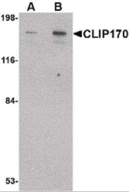 Western blot analysis of CLIP170 in rat brain tissue lysate with CLIP170 antibody at (A) 0.5 and (B) 1 &#956;g/mL.