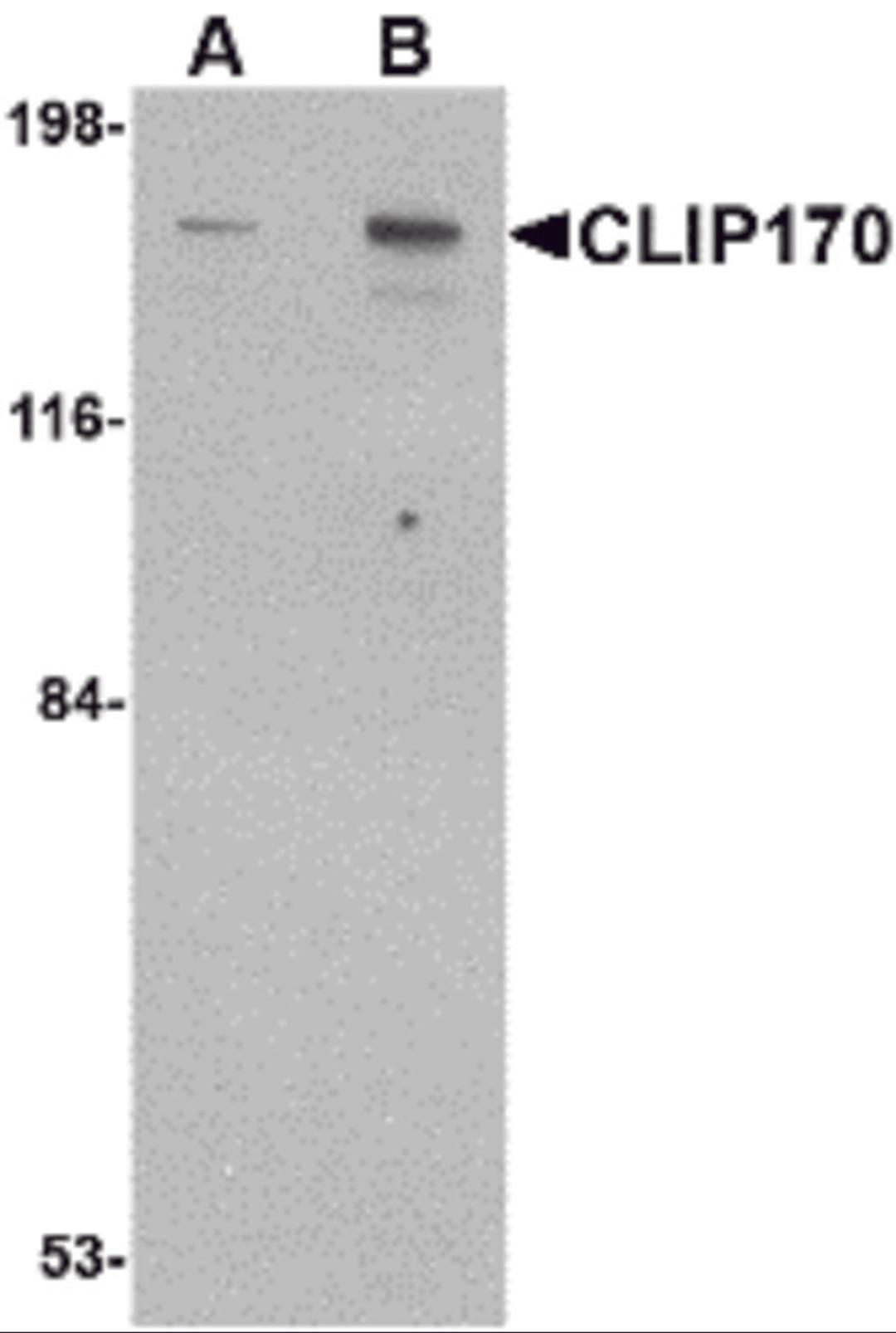 Western blot analysis of CLIP170 in rat brain tissue lysate with CLIP170 antibody at (A) 0.5 and (B) 1 μg/mL.