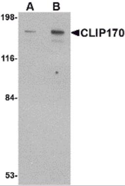Western blot analysis of CLIP170 in rat brain tissue lysate with CLIP170 antibody at (A) 0.5 and (B) 1 μg/mL.