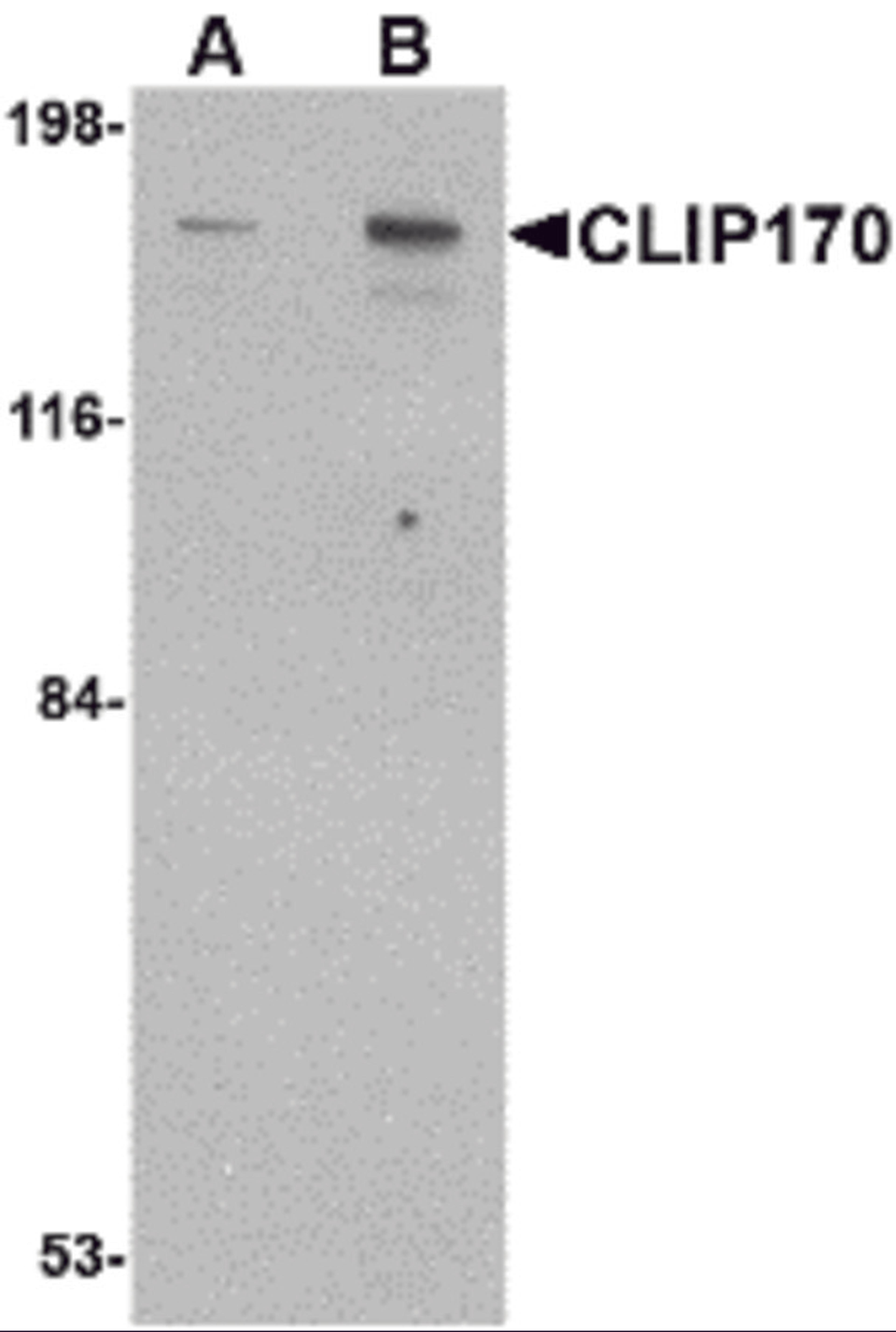 Western blot analysis of CLIP170 in rat brain tissue lysate with CLIP170 antibody at (A) 0.5 and (B) 1 μg/mL.