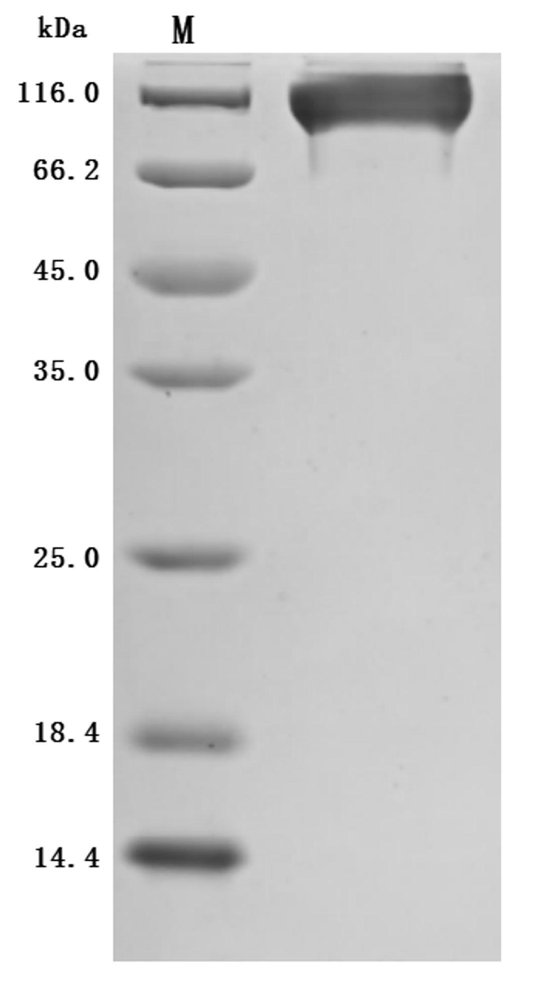 (Tris-Glycine gel) Discontinuous SDS-PAGE (reduced) with 5% enrichment gel and 15% separation gel.