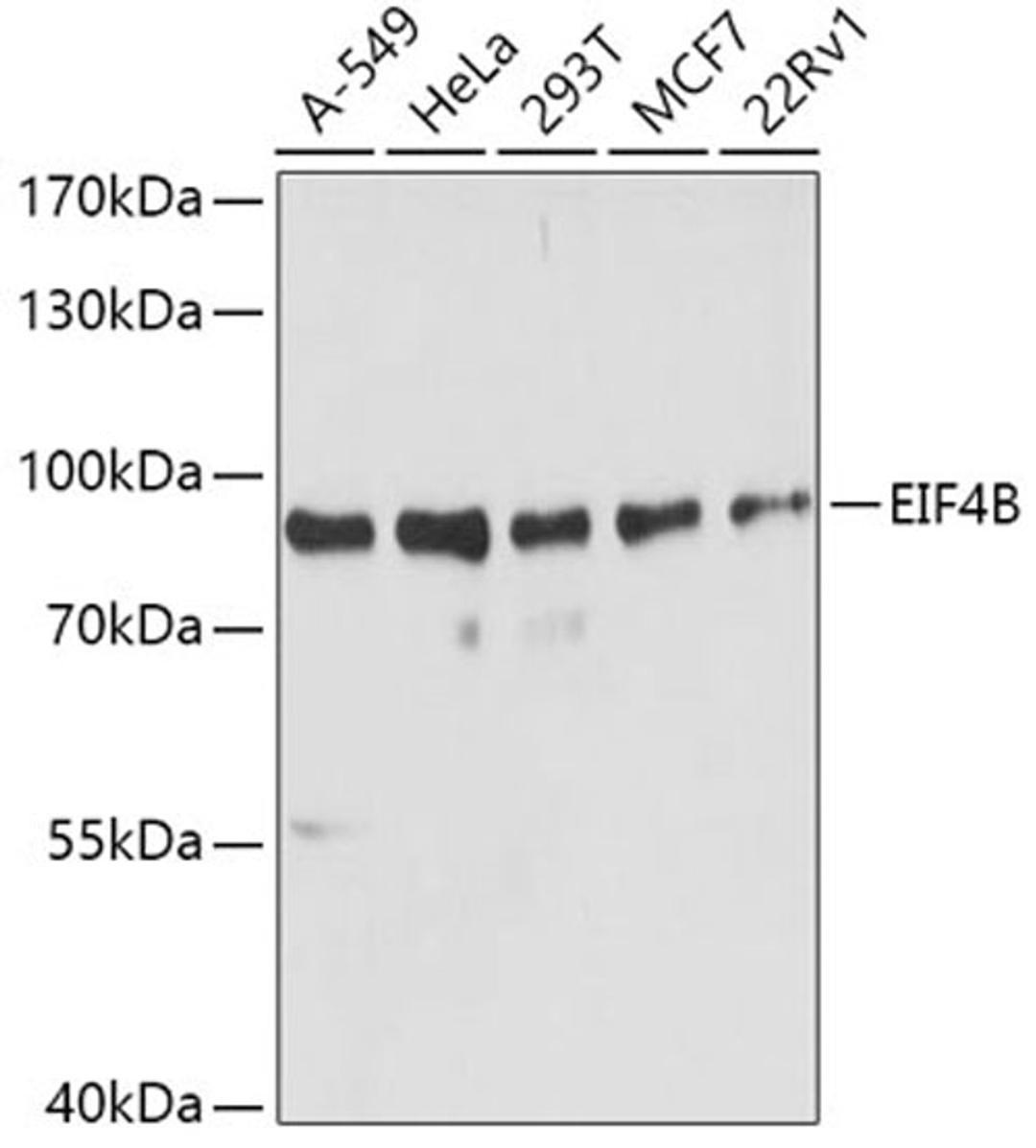 Western blot - EIF4B antibody (A5405)