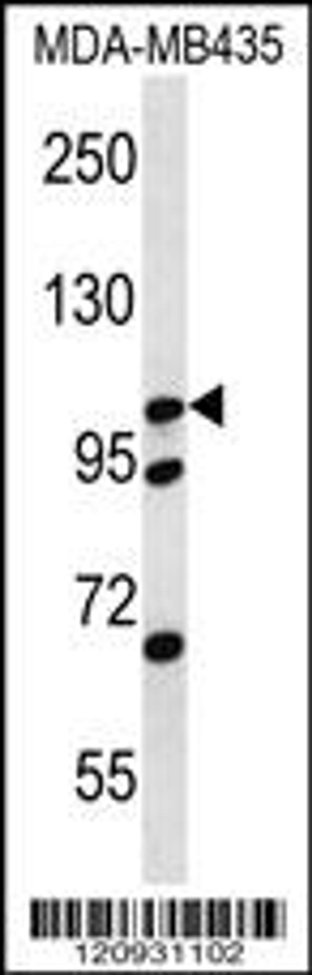 Western blot analysis in MDA-MB435 cell line lysates (35ug/lane).