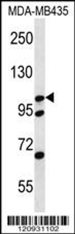 Western blot analysis in MDA-MB435 cell line lysates (35ug/lane).