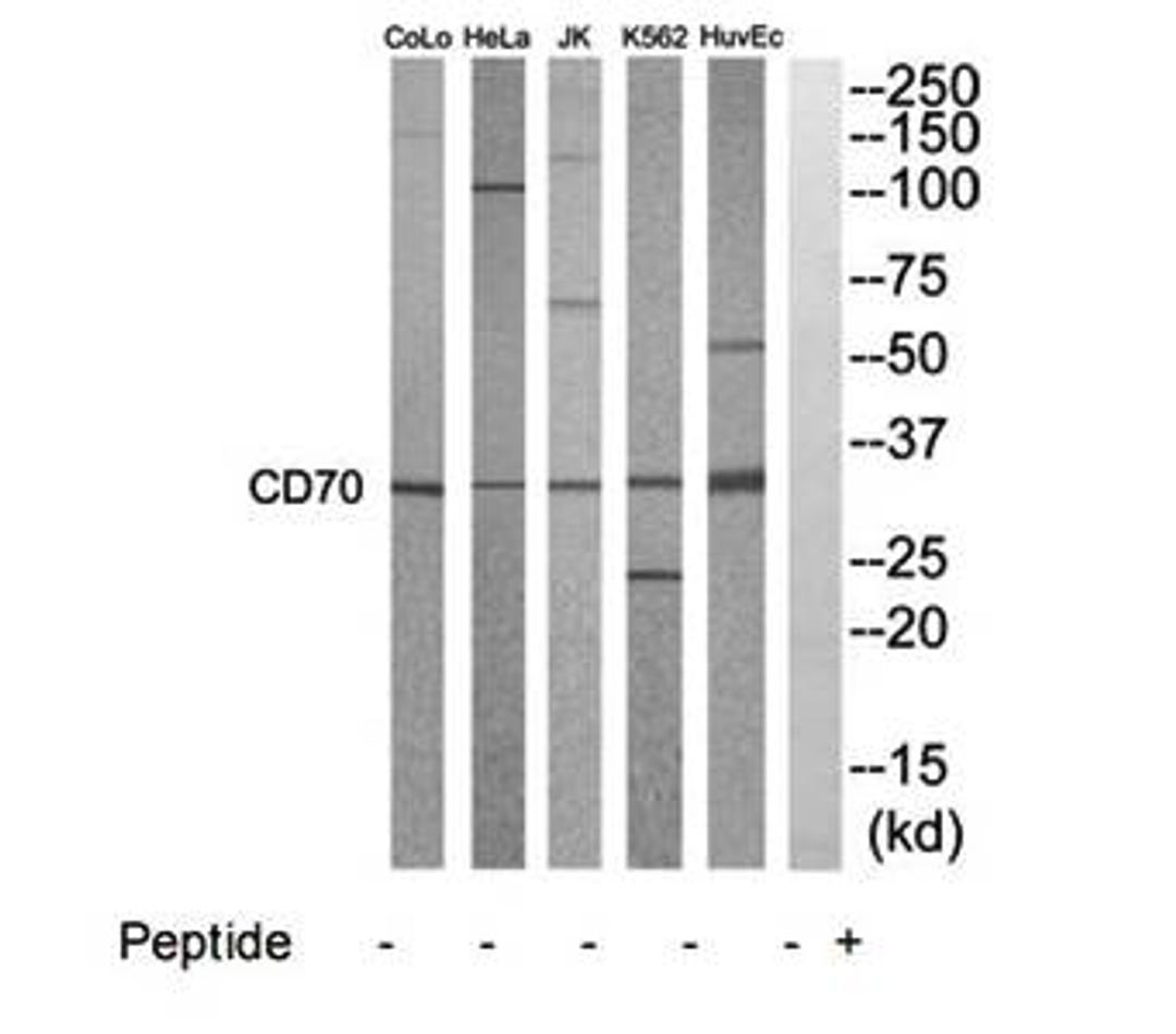 Western blot analysis of extracts from HuvEC, K562, HepG2, Jurkat, HeLa and COLO205 cells using CD70 antibody