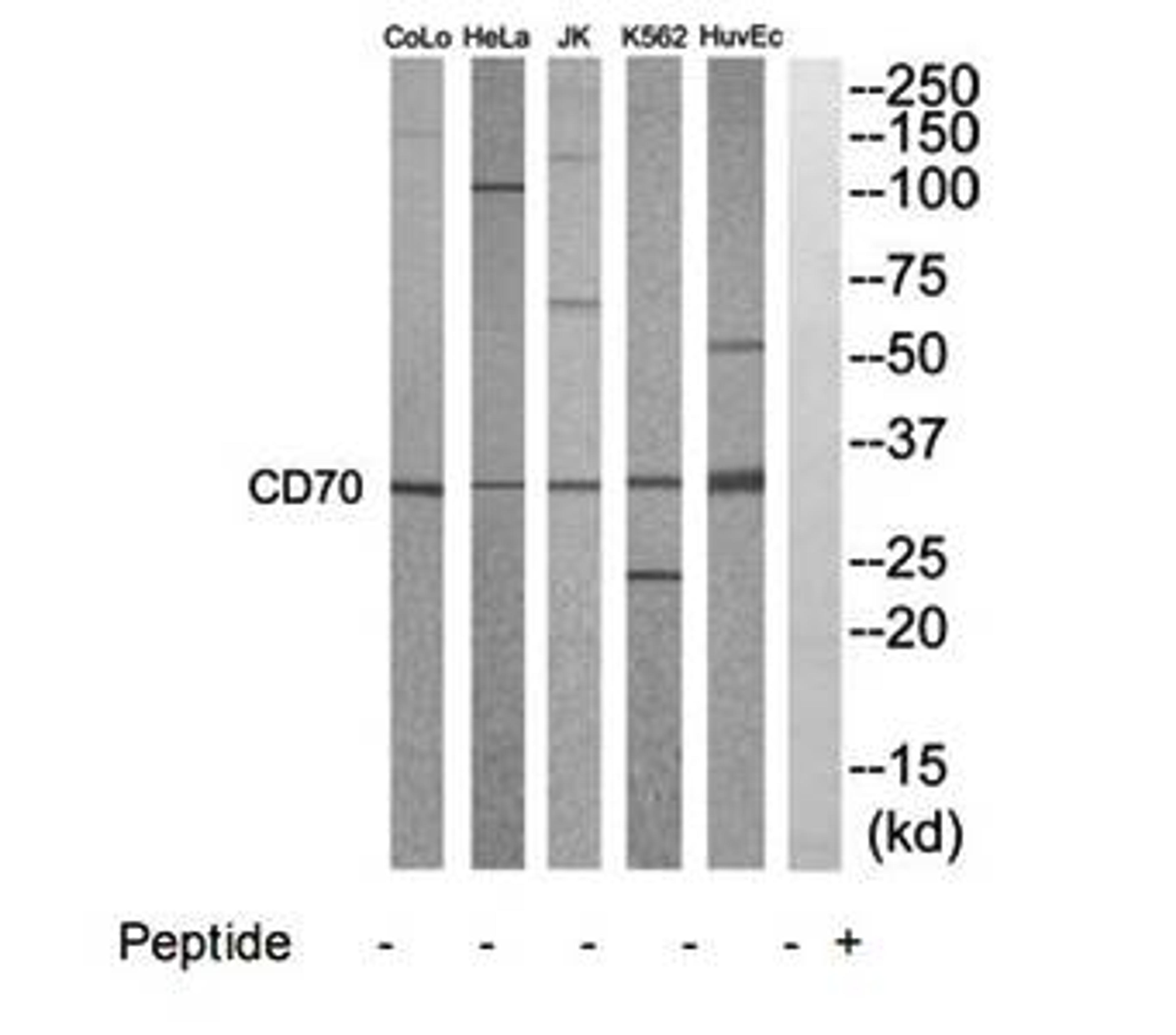 Western blot analysis of extracts from HuvEC, K562, HepG2, Jurkat, HeLa and COLO205 cells using CD70 antibody