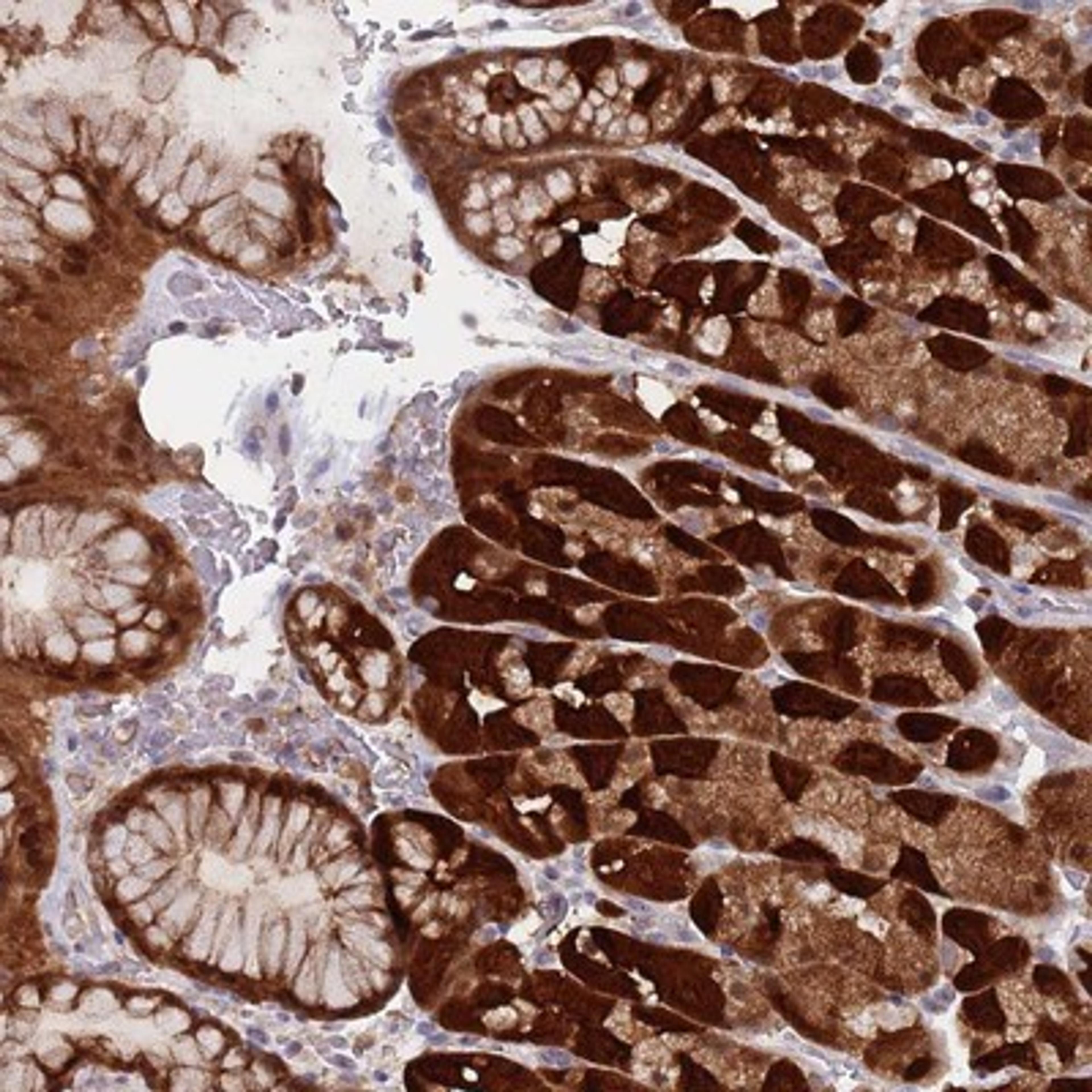 Immunohistochemistry-Paraffin: C5orf35 Antibody [NBP2-13299] - Staining of human stomach, lower shows strong cytoplasmic and nuclear positivity in glandular cells.