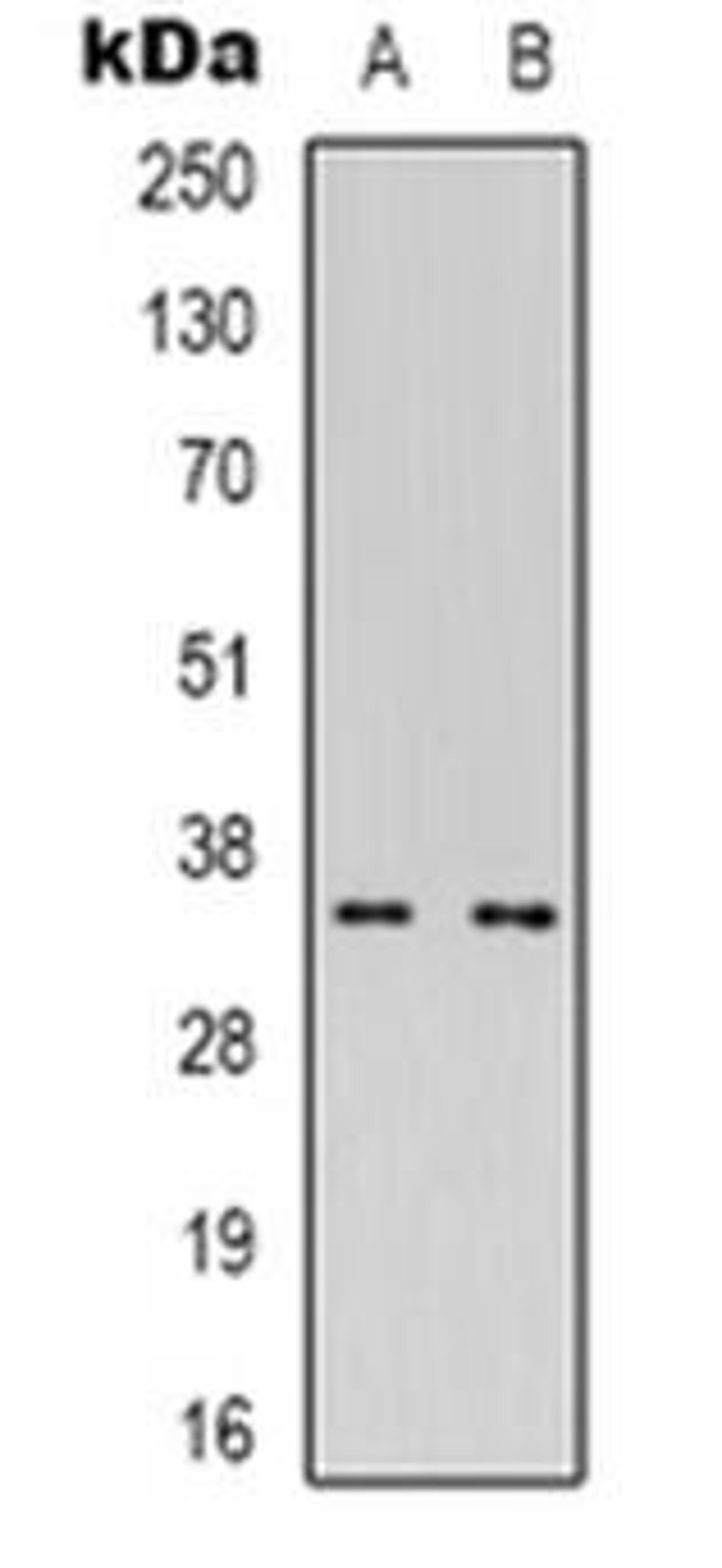 Western blot analysis of CDC42EP4 expression in Hela (Lane 1), Jurkat (Lane 2) whole cell lysates using CDC42EP4 antibody