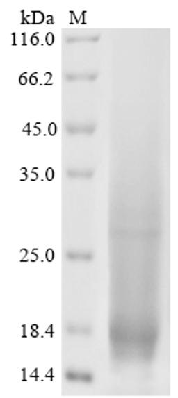 (Tris-Glycine gel) Discontinuous SDS-PAGE (reduced) with 5% enrichment gel and 15% separation gel.