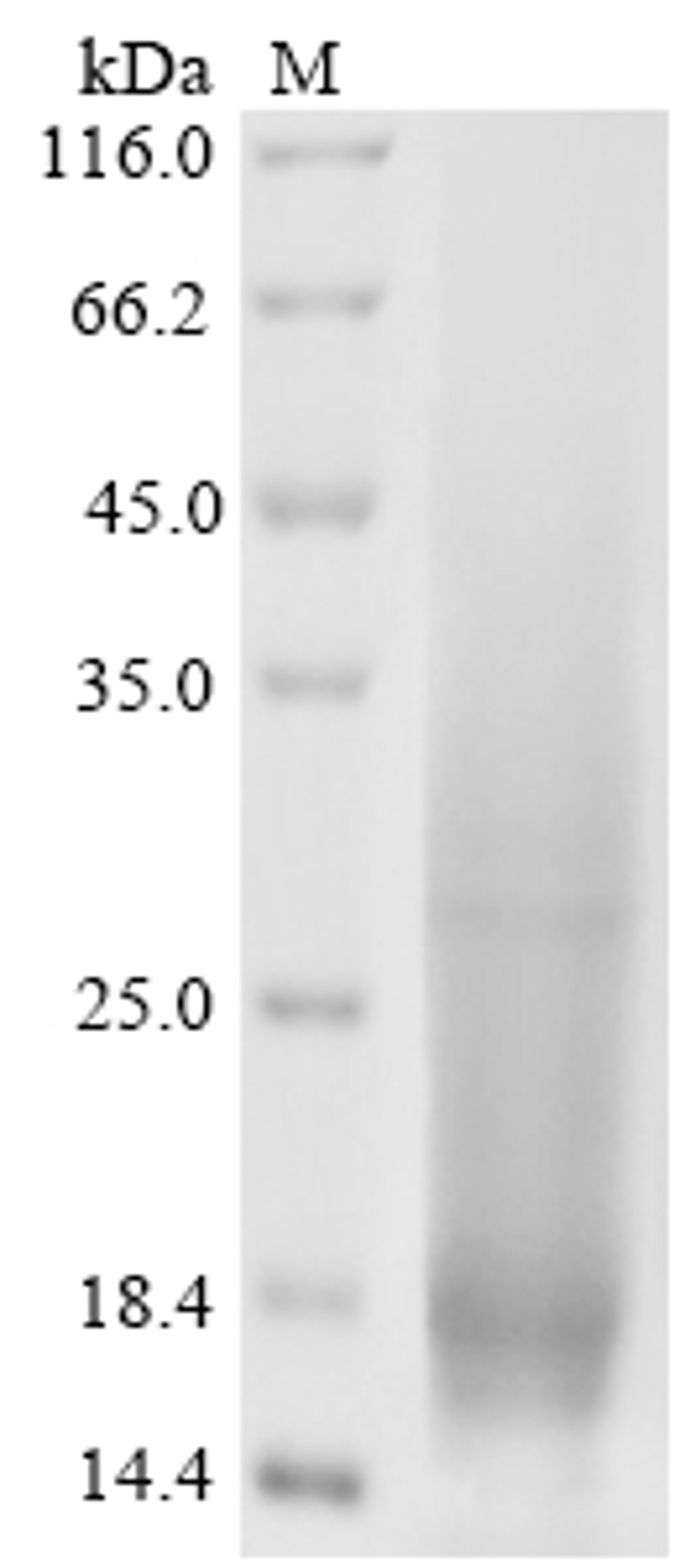 (Tris-Glycine gel) Discontinuous SDS-PAGE (reduced) with 5% enrichment gel and 15% separation gel.