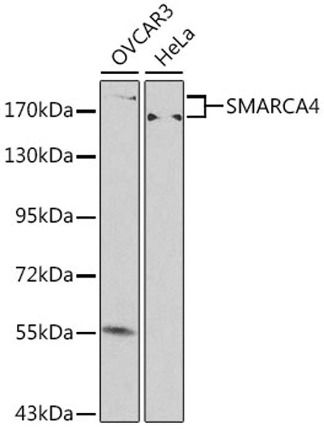 Western blot - SMARCA4 antibody (A0887)