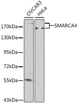 Western blot - SMARCA4 antibody (A0887)