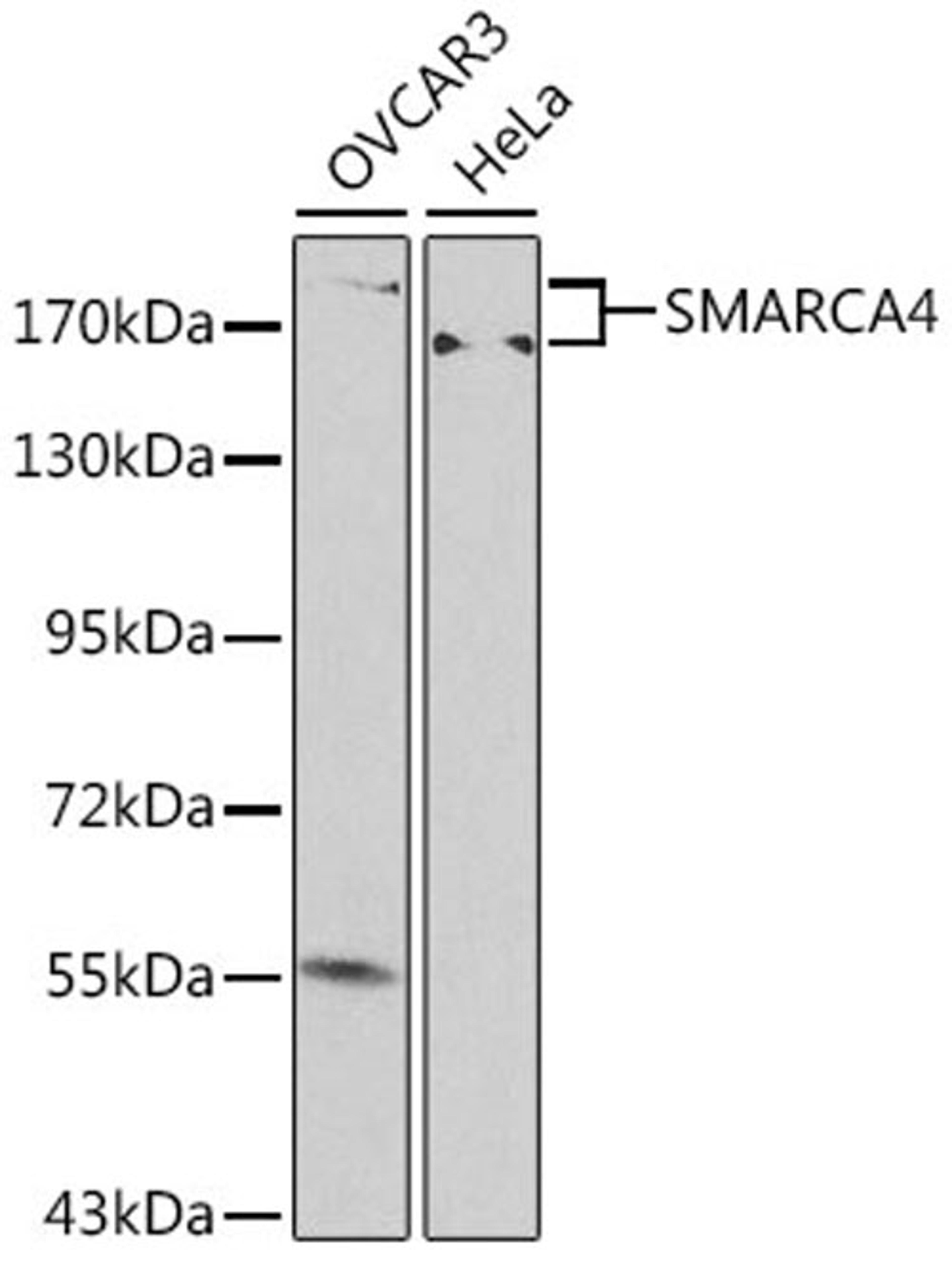 Western blot - SMARCA4 antibody (A0887)