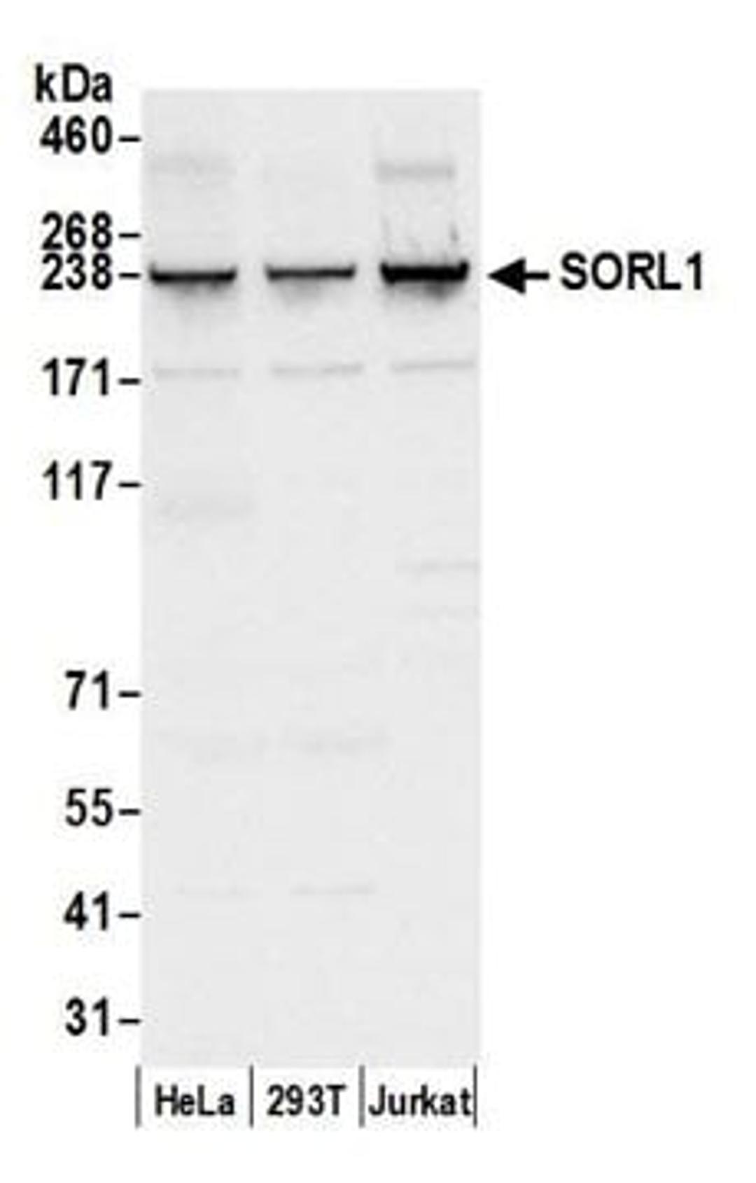 Detection of human SORL1 by western blot.