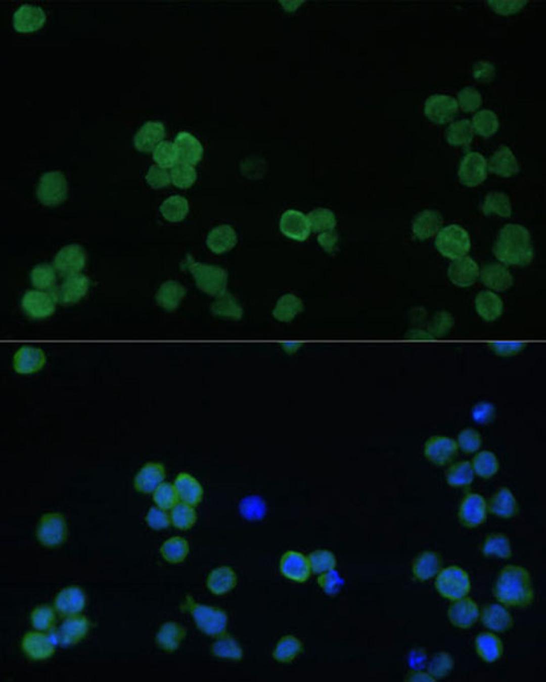 Immunofluorescence - GP1BA Polyclonal Antibody (A16048)