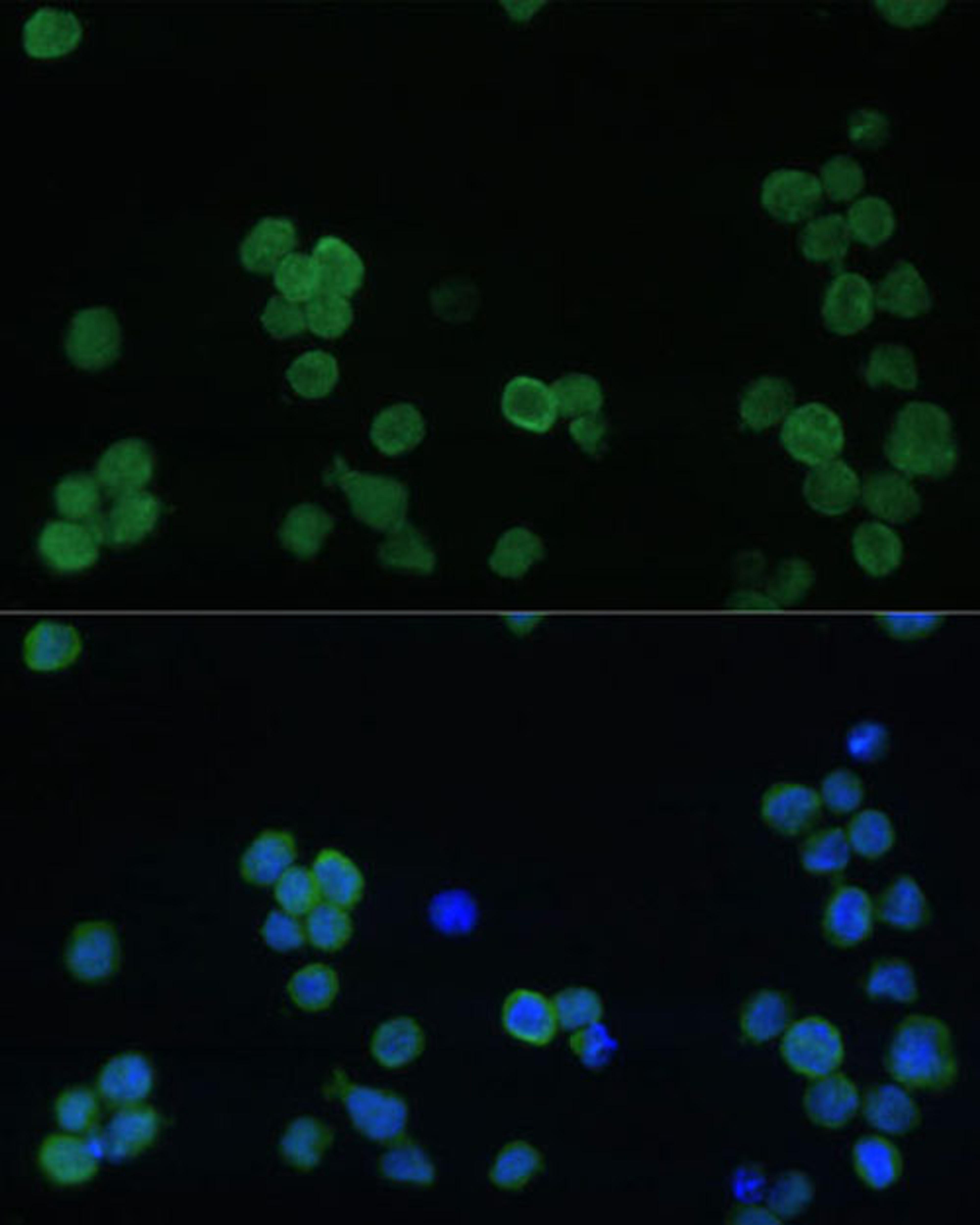 Immunofluorescence - GP1BA Polyclonal Antibody (A16048)