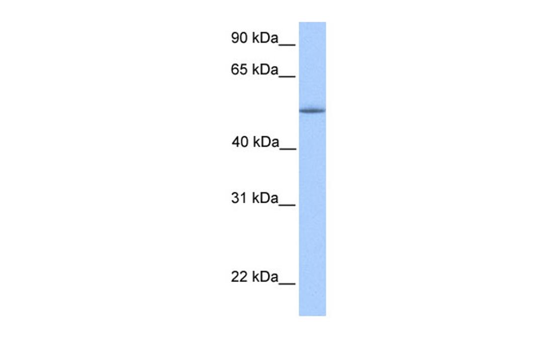 Antibody used in WB on Human Liver at 0.2-1 ug/ml.