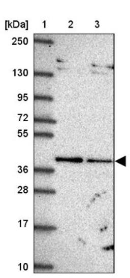 Western Blot: TIMM50 Antibody [NBP2-38791] - Lane 1: Marker [kDa] 250, 130, 95, 72, 55, 36, 28, 17, 10<br/>Lane 2: RT-4<br/>Lane 3: U-251 MG