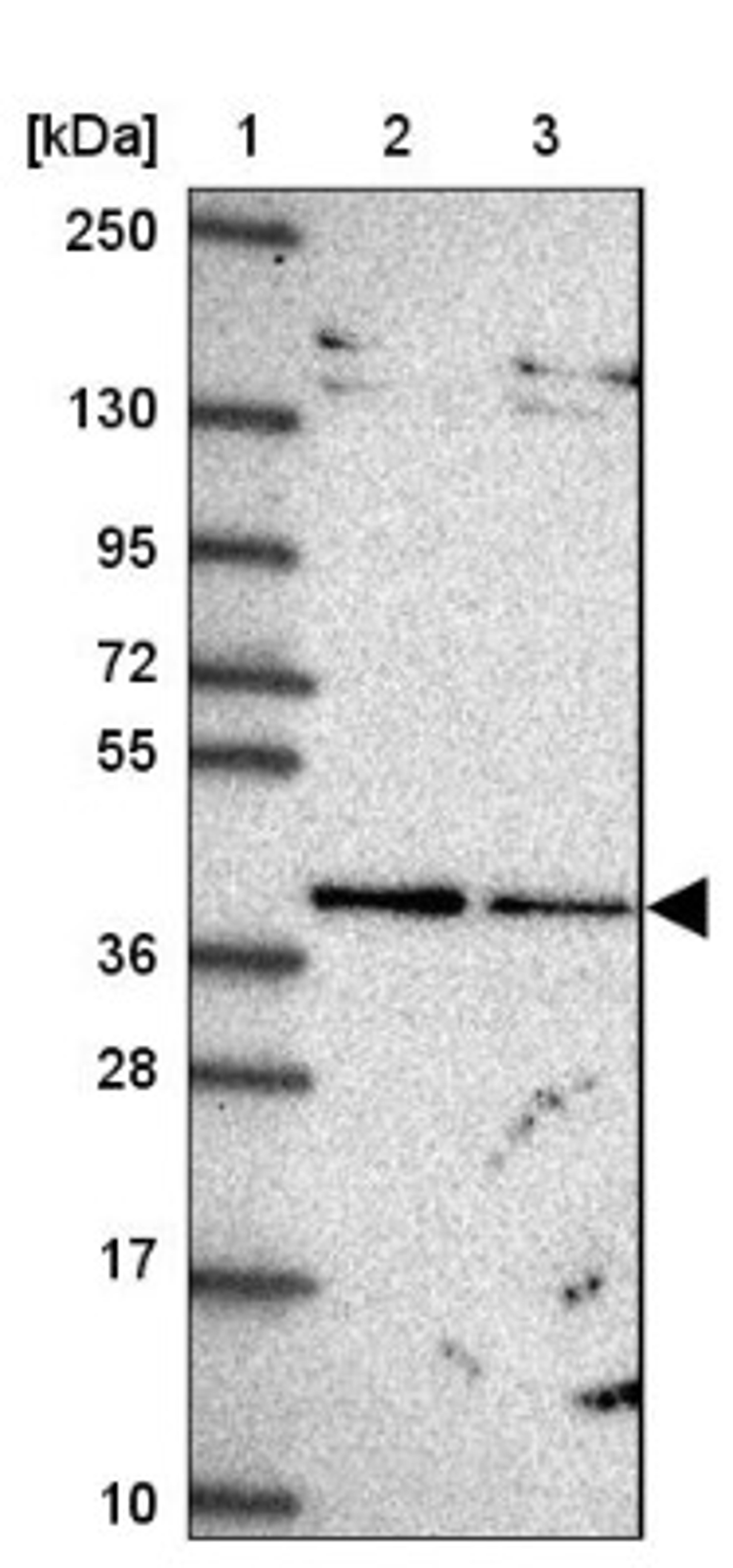 Western Blot: TIMM50 Antibody [NBP2-38791] - Lane 1: Marker [kDa] 250, 130, 95, 72, 55, 36, 28, 17, 10<br/>Lane 2: RT-4<br/>Lane 3: U-251 MG