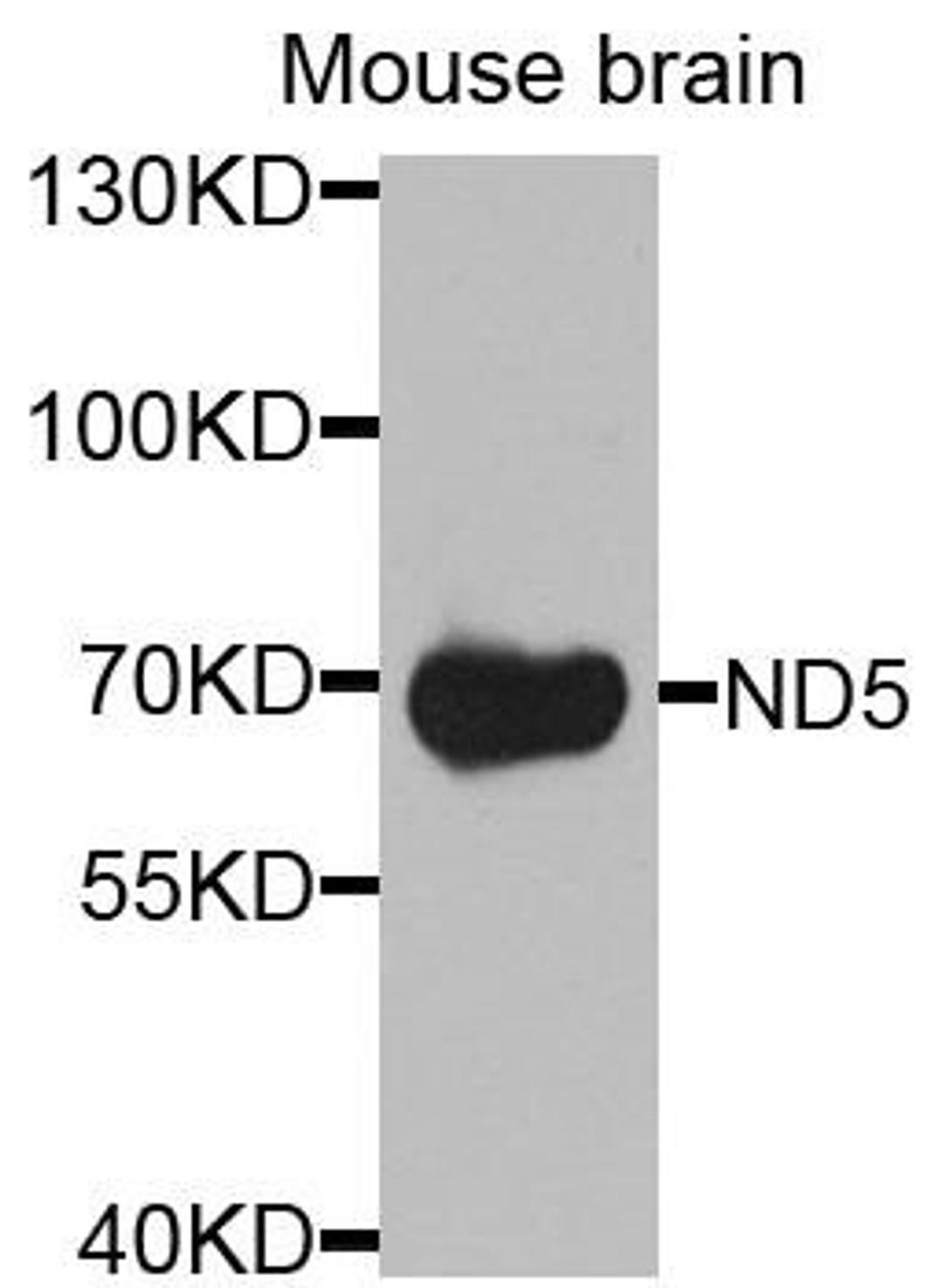 Western blot analysis of extracts of mouse brain using ND5 antibody