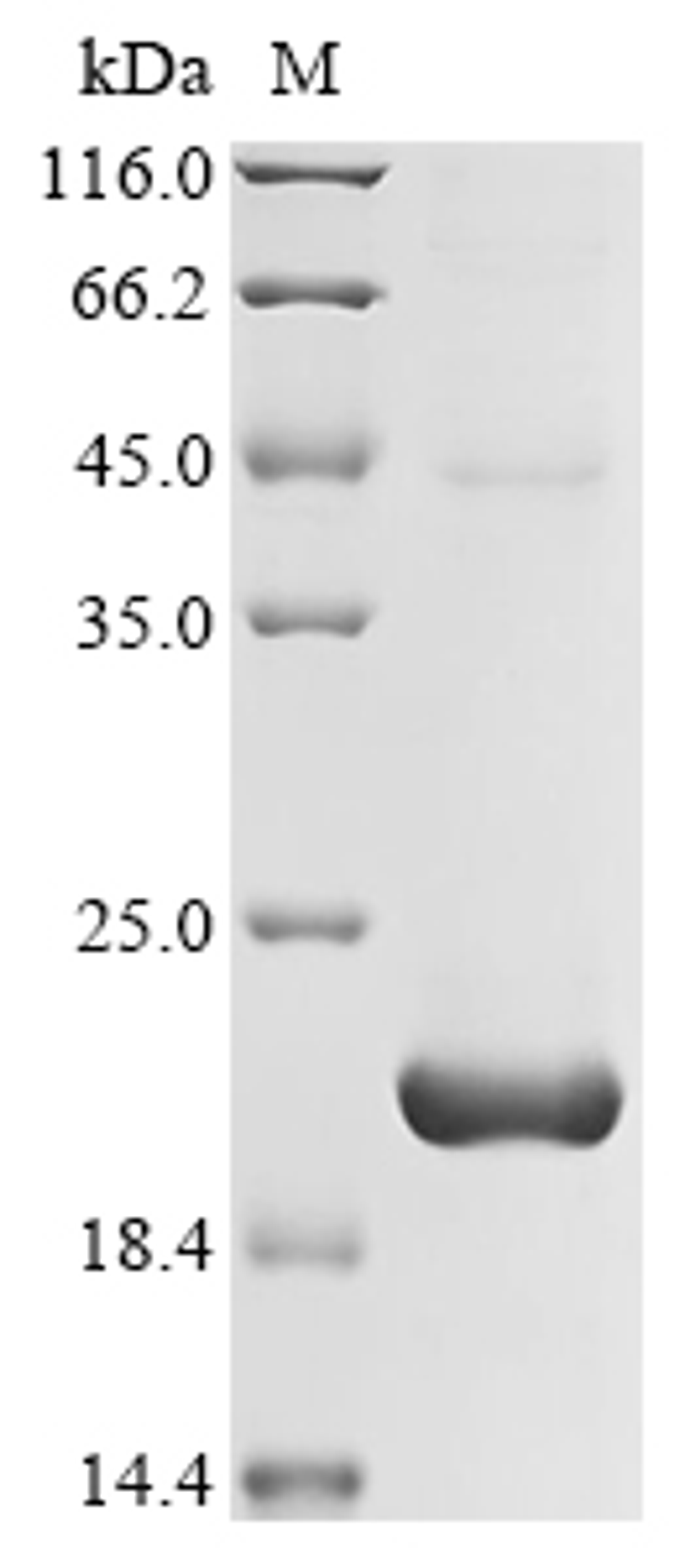 (Tris-Glycine gel) Discontinuous SDS-PAGE (reduced) with 5% enrichment gel and 15% separation gel.