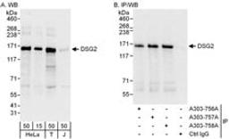 Detection of human DSG2 by western blot and immunoprecipitation.