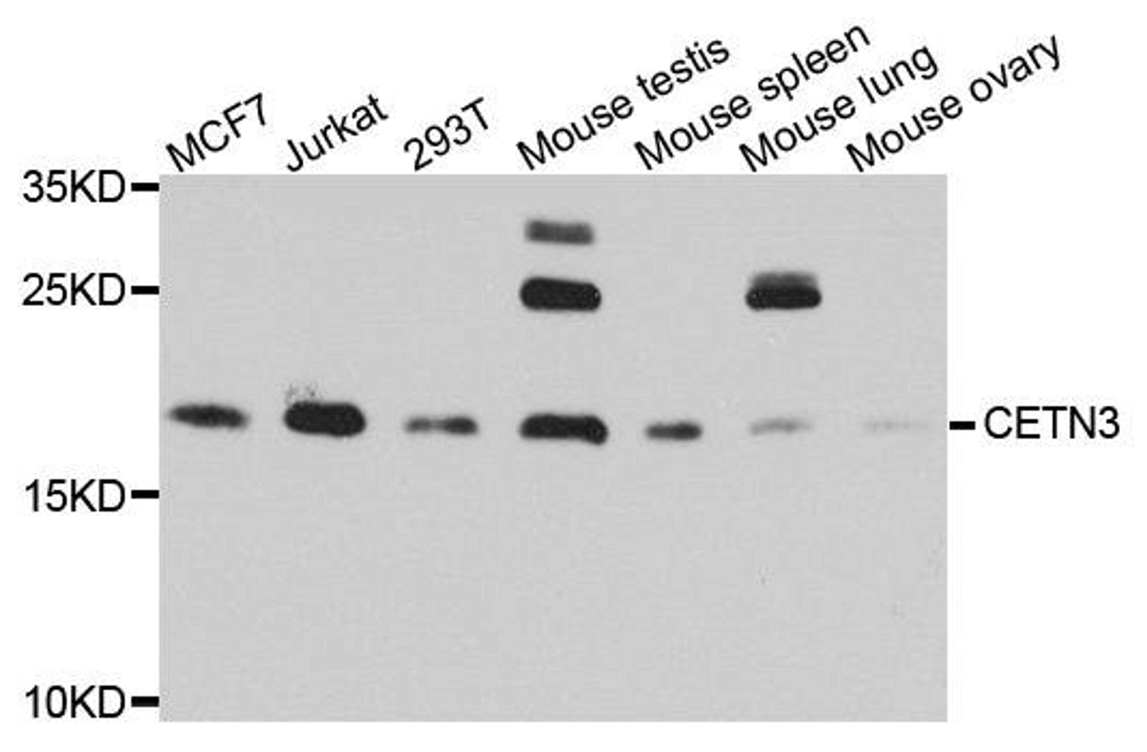 Western blot analysis of extract of various cells using CETN3 antibody