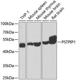 Western blot - PSTPIP1 antibody (A7760)