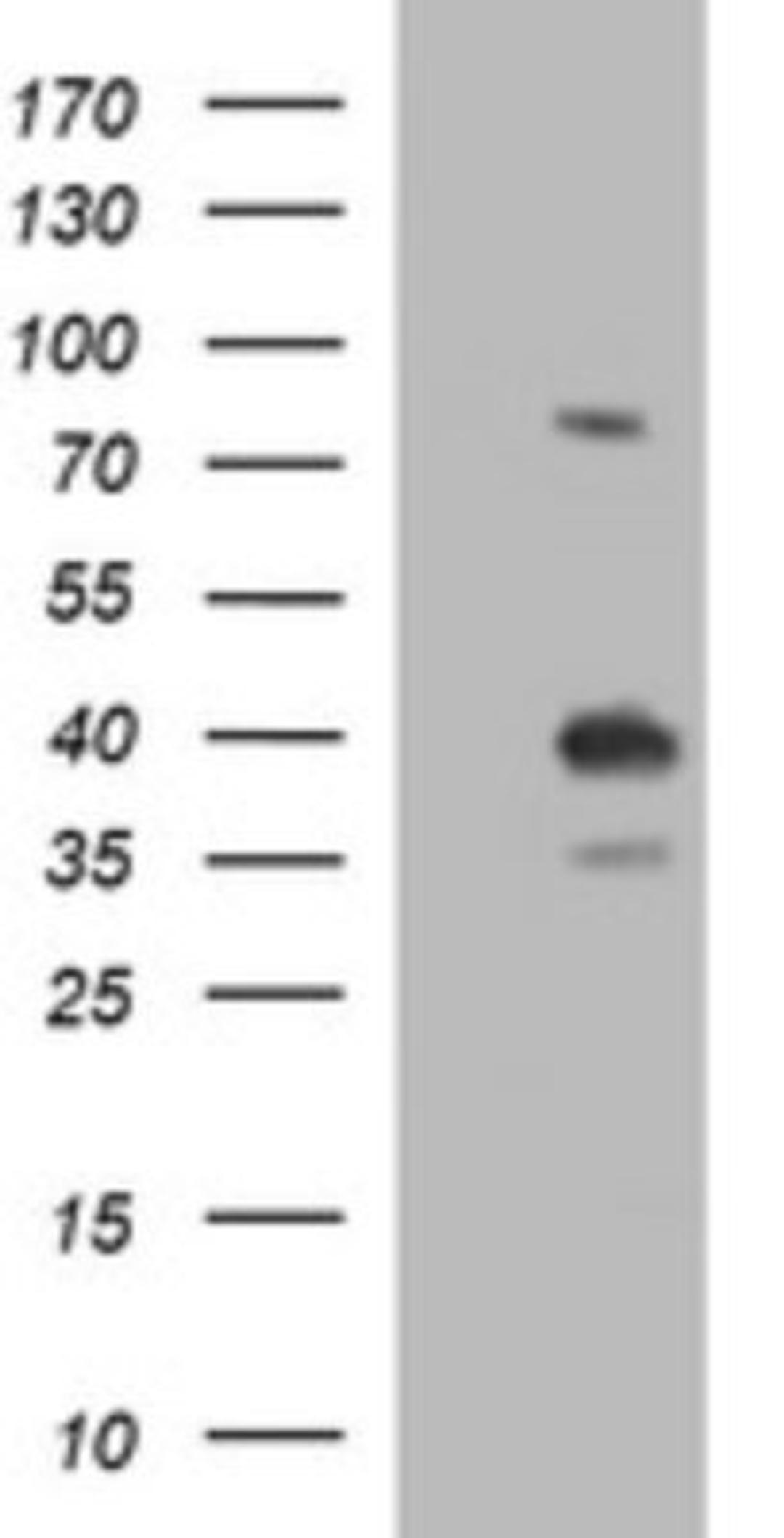 Western Blot: FUR1 Antibody (2D1) [NBP2-46297] - Analysis of HEK293T cells were transfected with the pCMV6-ENTRY control (Left lane) or pCMV6-ENTRY FUR1.