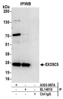 Detection of human EXOSC5 by western blot of immunoprecipitates.