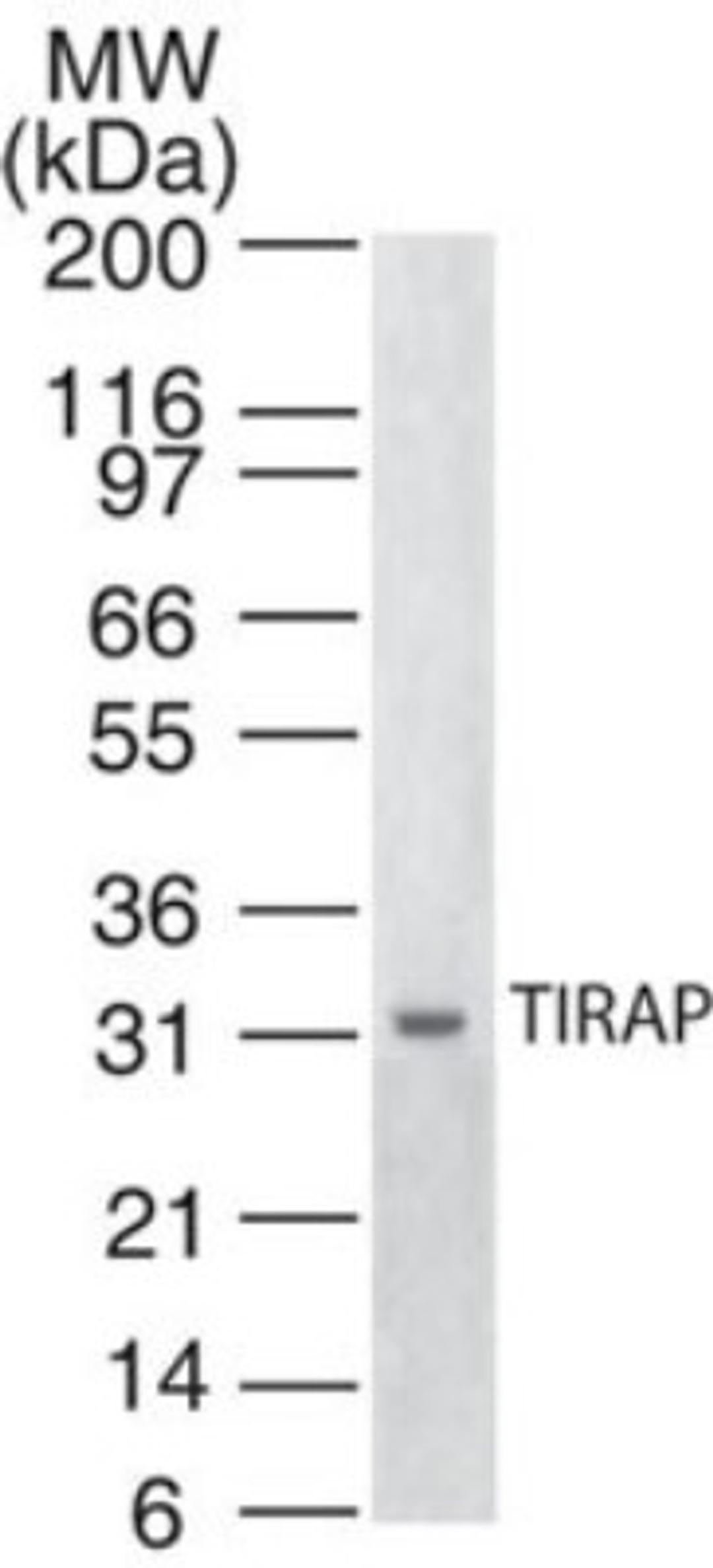 Western Blot: TIRAP (TLR2 and TLR4) Antibody (20D1055.1) [NB100-56730] - analysis of TIRAP in human spleen lysate using this antibody.