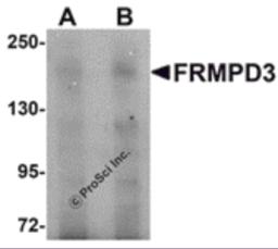 Western blot analysis of FRMPD3 in Jurkat cell lysate with FRMPD3 antibody at (A) 1 and (B) 2 &#956;g/mL.