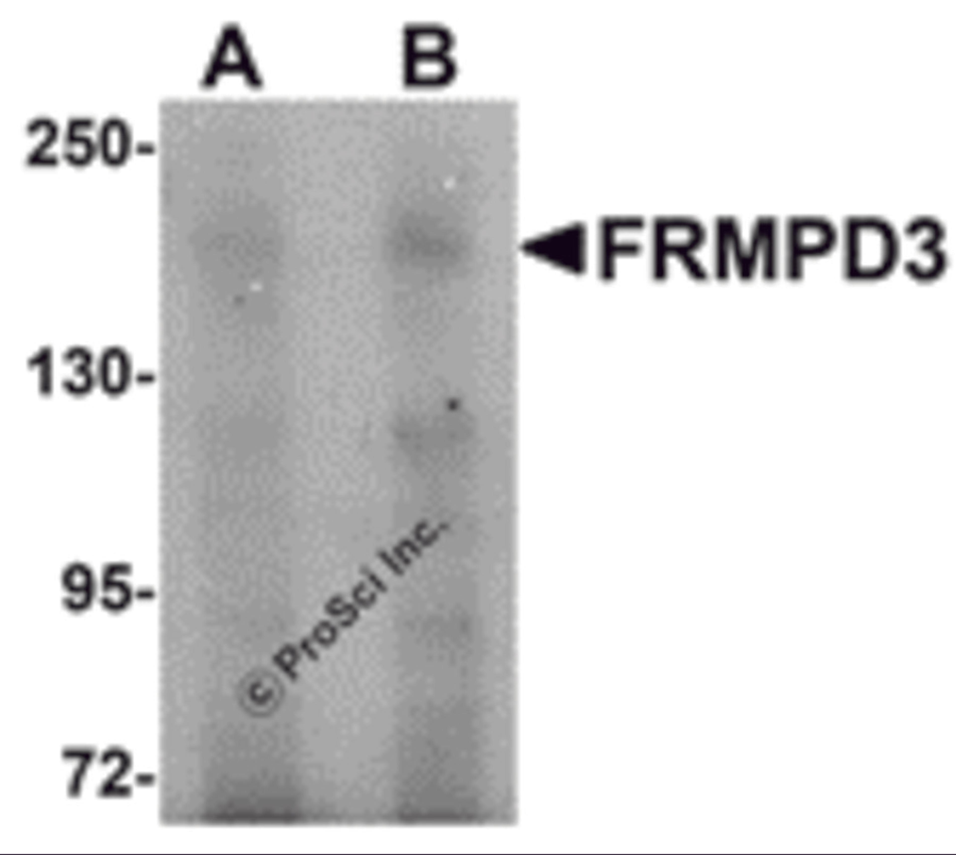 Western blot analysis of FRMPD3 in Jurkat cell lysate with FRMPD3 antibody at (A) 1 and (B) 2 &#956;g/mL.