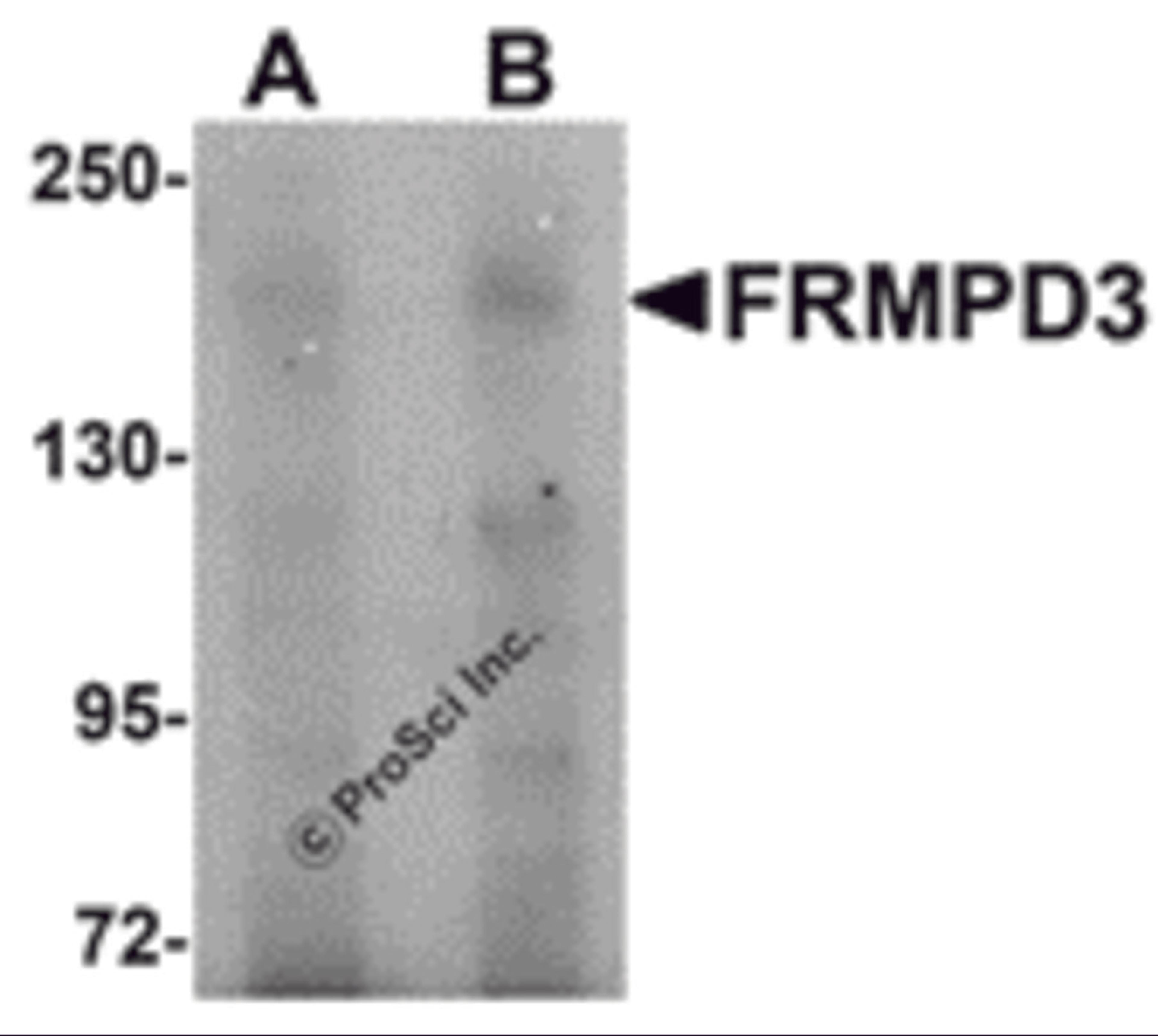 Western blot analysis of FRMPD3 in Jurkat cell lysate with FRMPD3 antibody at (A) 1 and (B) 2 μg/mL.