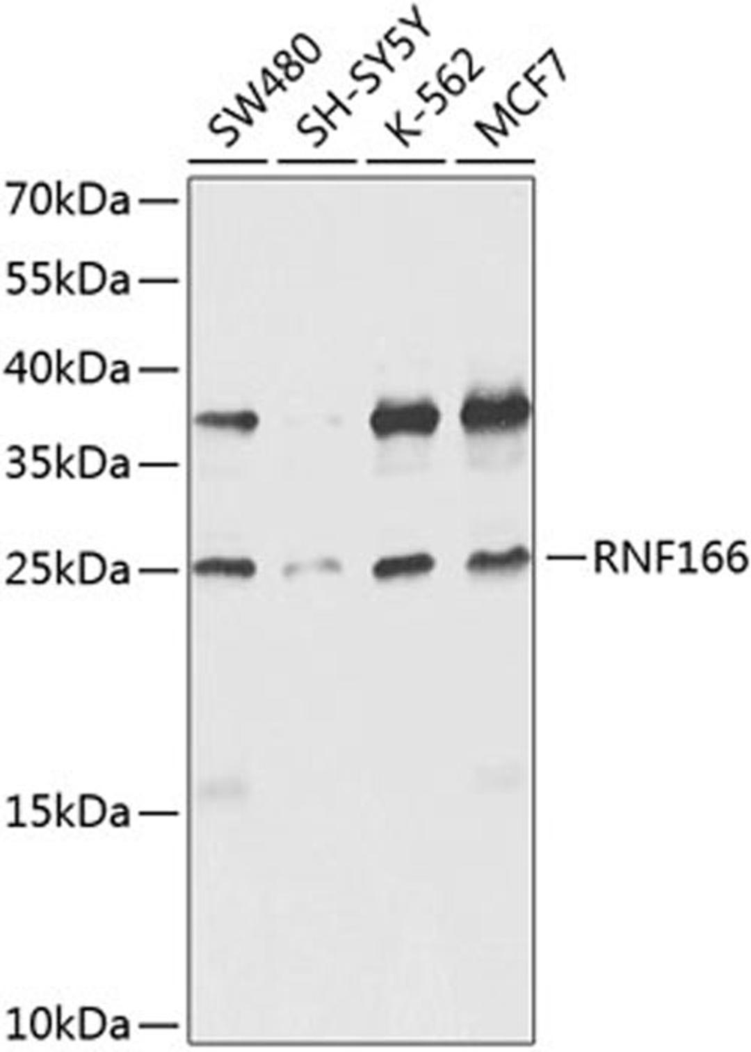 Western blot - RNF166 antibody (A8276)