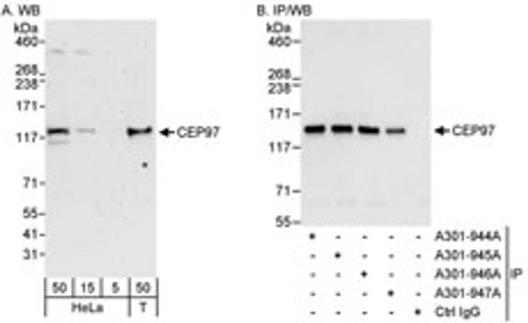 Detection of human CEP97 by western blot and immunoprecipitation.