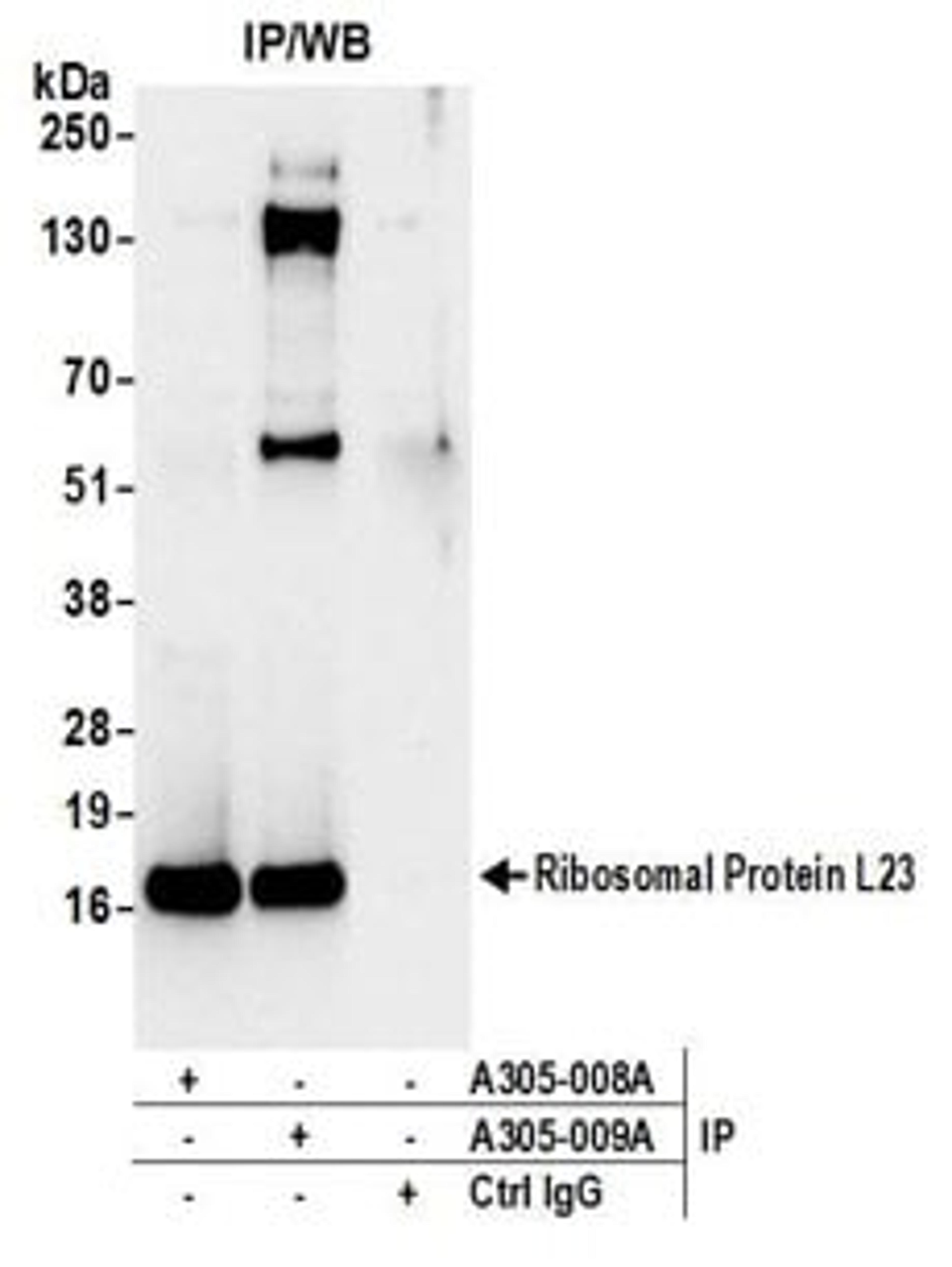 Detection of human Ribosomal Protein L23 by western blot of immunoprecipitates.