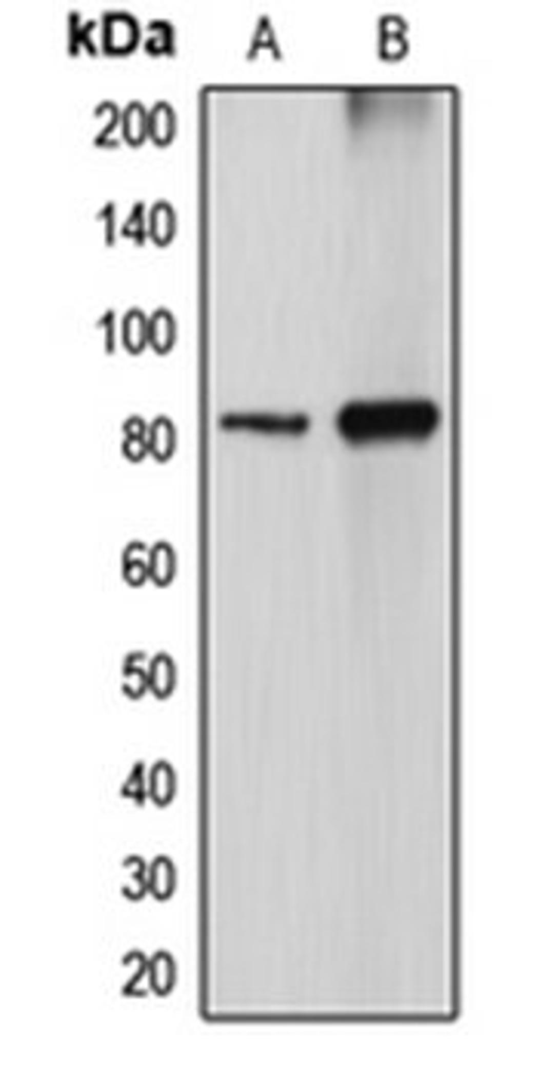 Western blot analysis of MDCK (Lane 1), COS7 (Lane 2) whole cell lysates using DGKA antibody