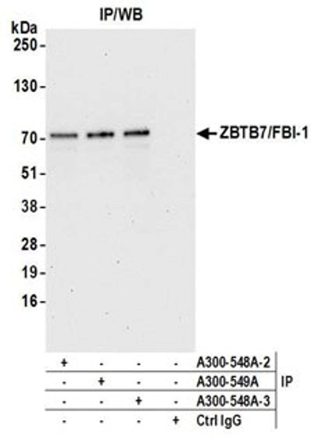 Detection of human ZBTB7/FBI-1 by western blot of immunoprecipitates.