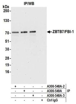 Detection of human ZBTB7/FBI-1 by western blot of immunoprecipitates.