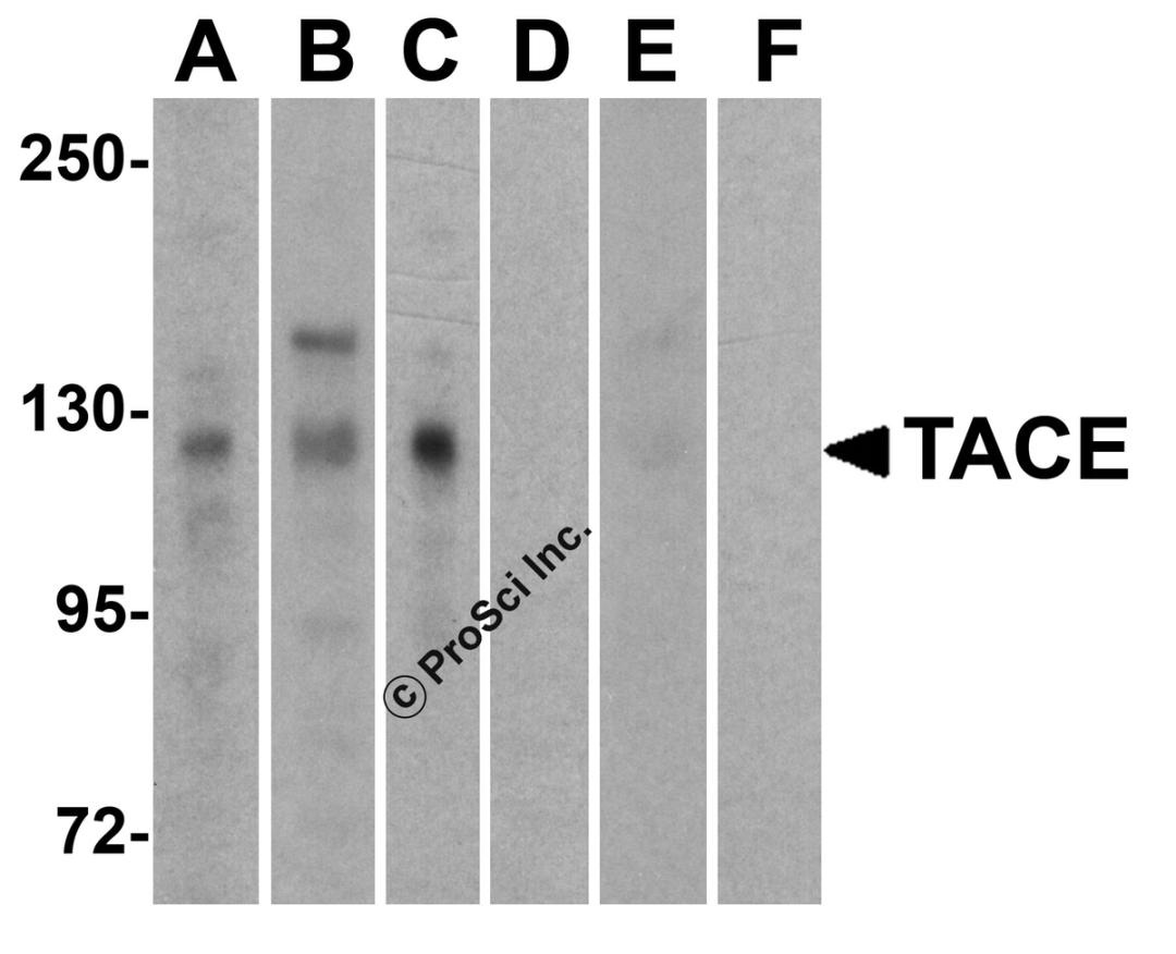 <strong>Figure 1 Western Blot Validation of TACE in Human Cell Lines</strong><br>
Loading: 15 &#956;g of lysates per lane.
Antibodies: TACE (1 µg/mL), 1h incubation at RT in 5% NFDM/TBST.
Secondary: Goat anti-rabbit IgG HRP conjugate at 1:10000 dilution.
