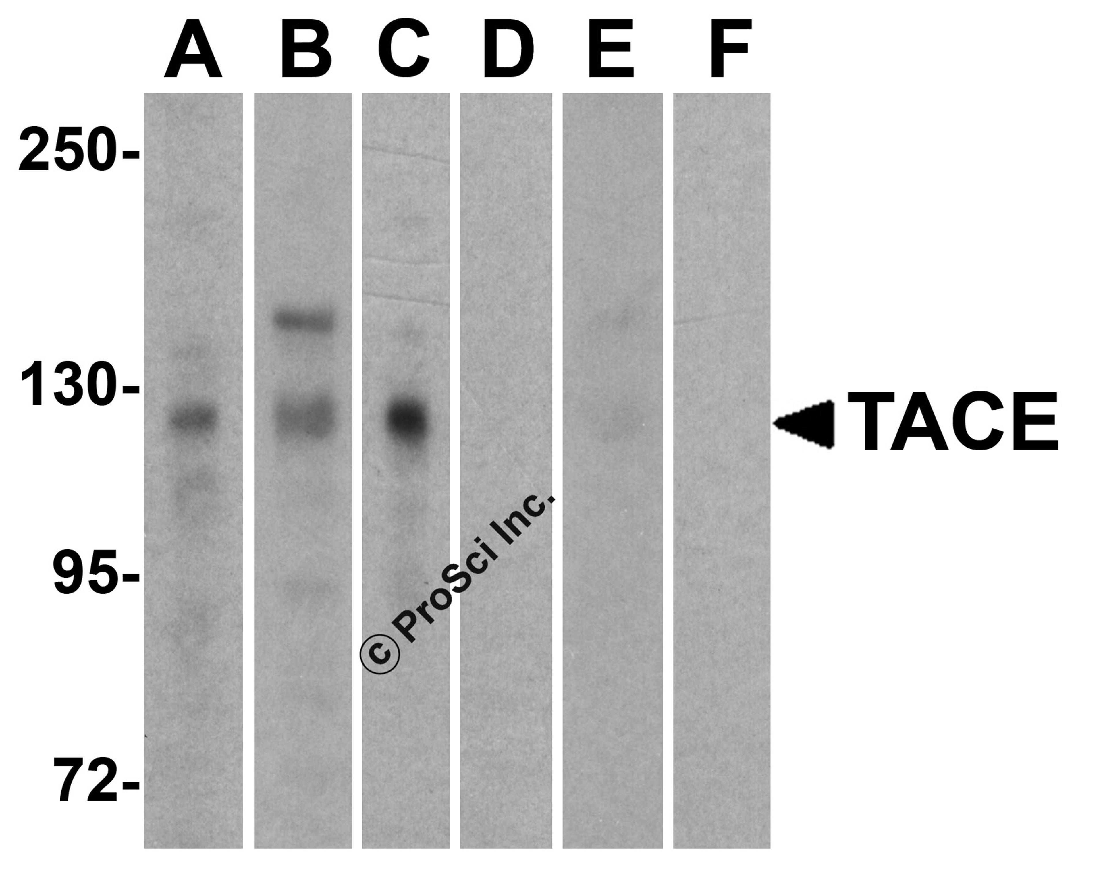 <strong>Figure 1 Western Blot Validation of TACE in Human Cell Lines</strong><br>
Loading: 15 &#956;g of lysates per lane.
Antibodies: TACE (1 µg/mL), 1h incubation at RT in 5% NFDM/TBST.
Secondary: Goat anti-rabbit IgG HRP conjugate at 1:10000 dilution.
