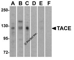 <strong>Figure 1 Western Blot Validation of TACE in Human Cell Lines</strong><br>
Loading: 15 μg of lysates per lane.
Antibodies: TACE (1 µg/mL), 1h incubation at RT in 5% NFDM/TBST.
Secondary: Goat anti-rabbit IgG HRP conjugate at 1:10000 dilution.