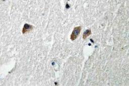 Immunohistochemistry-Paraffin: CaMKII Antibody [NBP2-13006] - Paraffin-embedded human brain tissue.