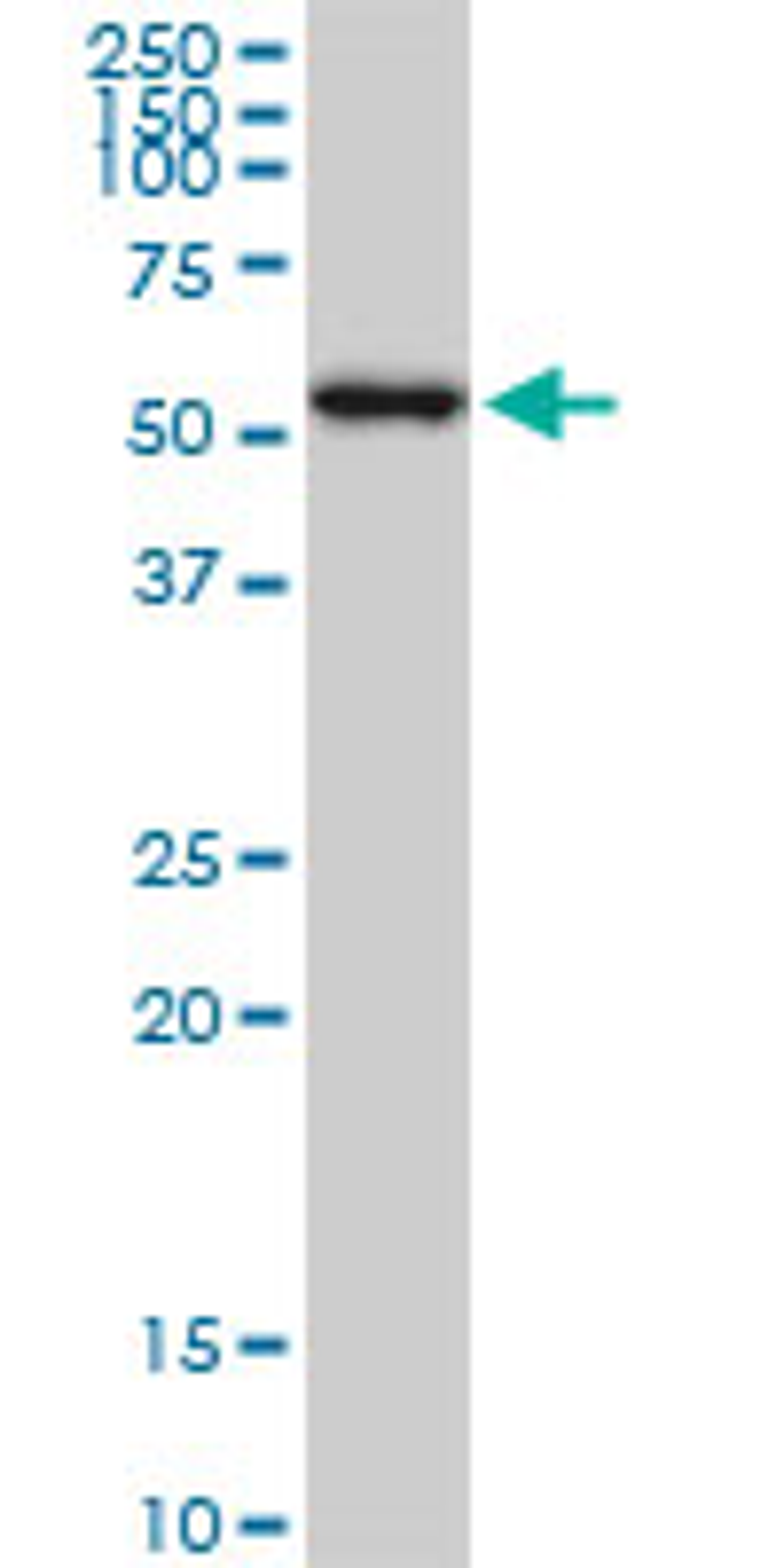 Western Blot analysis of AKT1 expression in PC-12 using Mouse anti Human AKT1 (MCA4779Z)