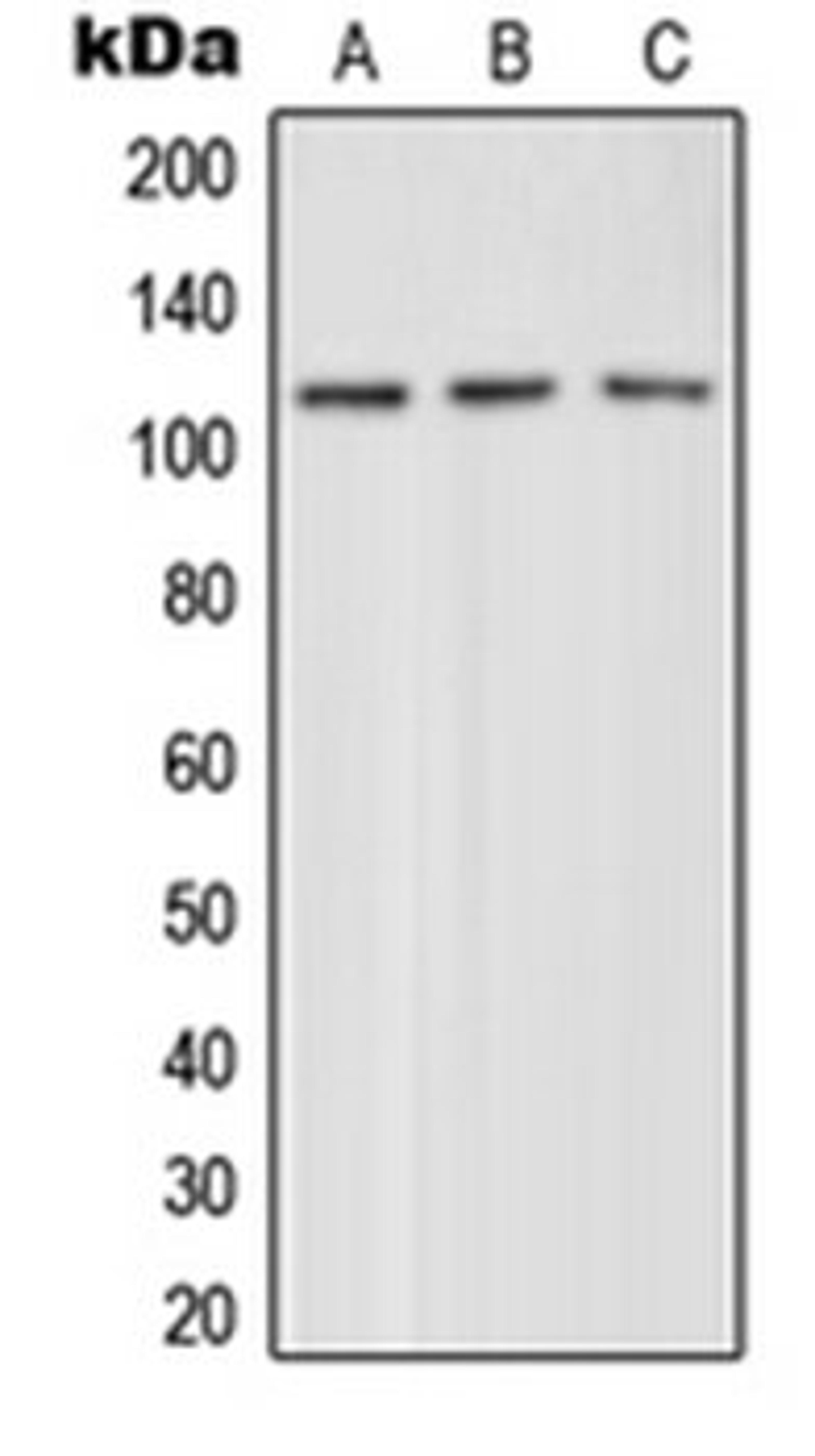 Western blot analysis of HeLa (Lane 1), mouse brain (Lane 2), rat brain (Lane 3) whole cell lysates using GRM4 antibody