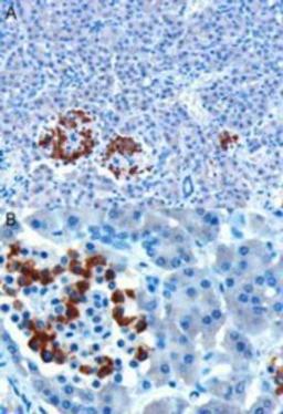 Immunohistochemistry: CCK-A R Antibody [NB100-2805] - Paraffin embedded Human Pancreas. Microwaved antigen retrieval with citrate buffer pH 6, HRP-staining.