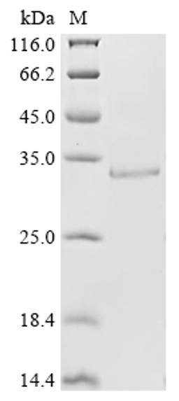 (Tris-Glycine gel) Discontinuous SDS-PAGE (reduced) with 5% enrichment gel and 15% separation gel.
