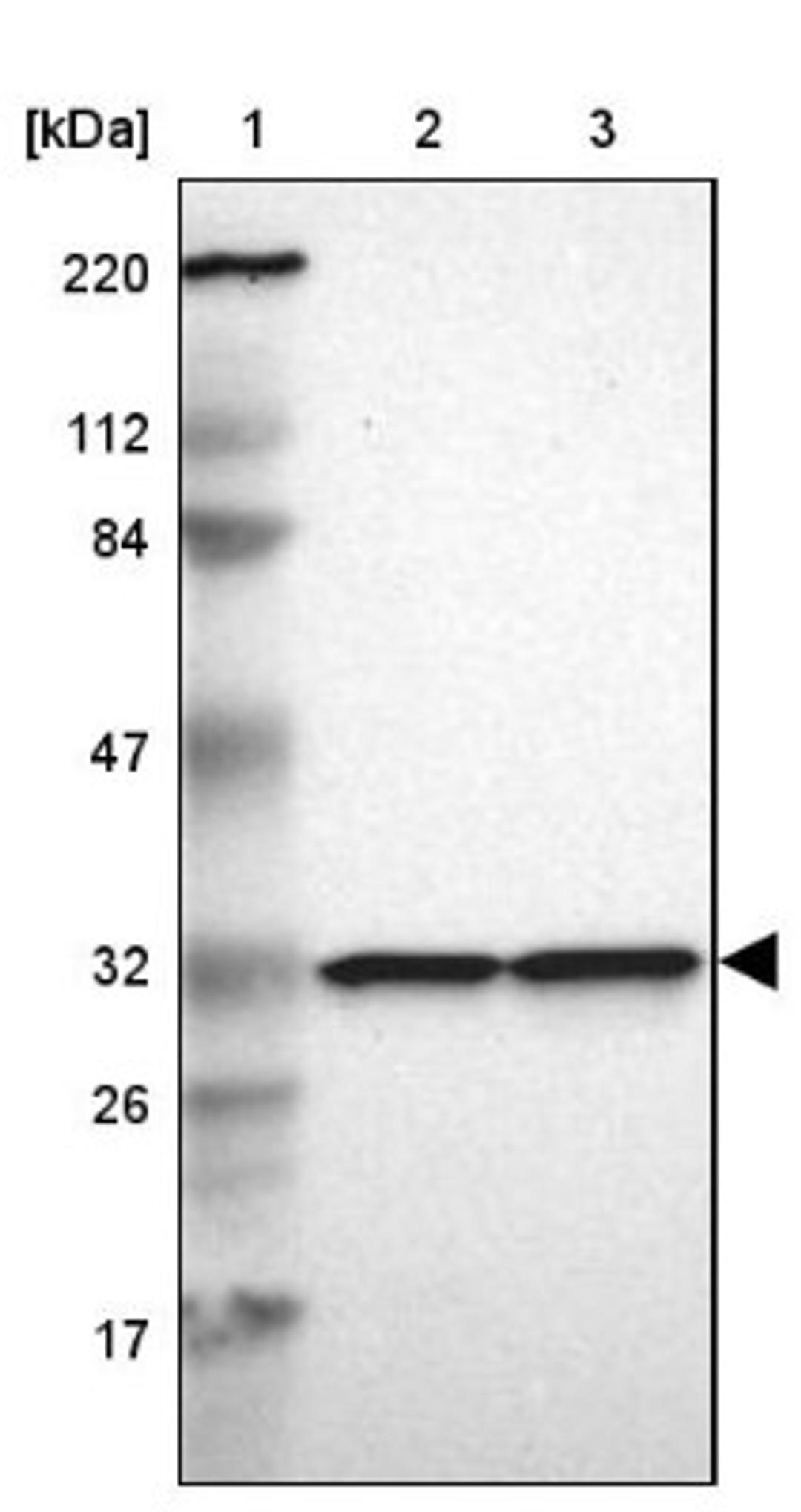 Western Blot: MAPRE1 Antibody [NBP1-84928] - Lane 1: Marker [kDa] 220, 112, 84, 47, 32, 26, 17<br/>Lane 2: Human cell line RT-4<br/>Lane 3: Human cell line U-251MG sp