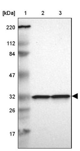 Western Blot: MAPRE1 Antibody [NBP1-84928] - Lane 1: Marker [kDa] 220, 112, 84, 47, 32, 26, 17<br/>Lane 2: Human cell line RT-4<br/>Lane 3: Human cell line U-251MG sp